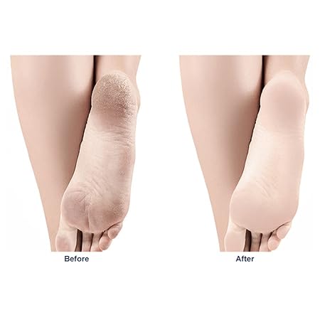 6195 Grinding Feet Artifact Exfoliating Nano glass Grinding Stone House Frustrated Feet Foot Scraping Heel 6195 Grinding Feet Artifact Exfoliating Nano glass Grinding Stone House Frustrated Feet Foot Scraping Heel